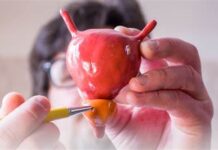 Descubra Como o G4 Nature Funciona: A Solução Natural Para a Saúde da Próstata Que Você Precisa Conhecer!