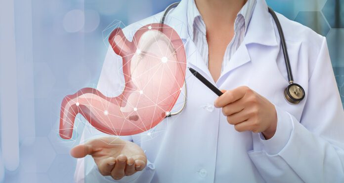 Cirurgia Bariátrica a Preço Popular