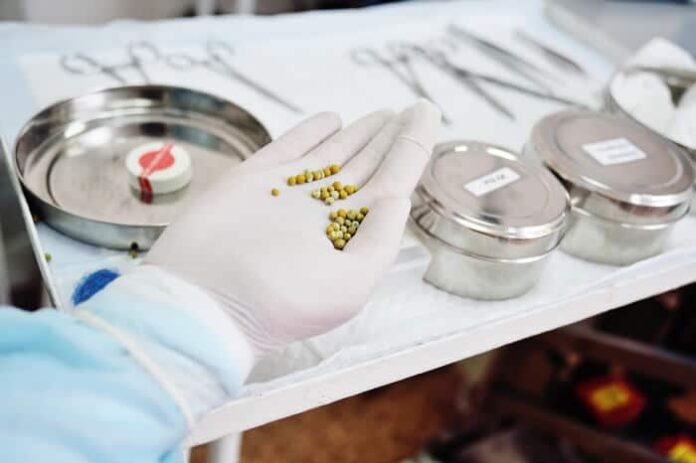 Cirurgia de Pedra na Vesícula em Fortaleza