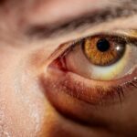 Olhos amarelados: 4 causas além da hepatite