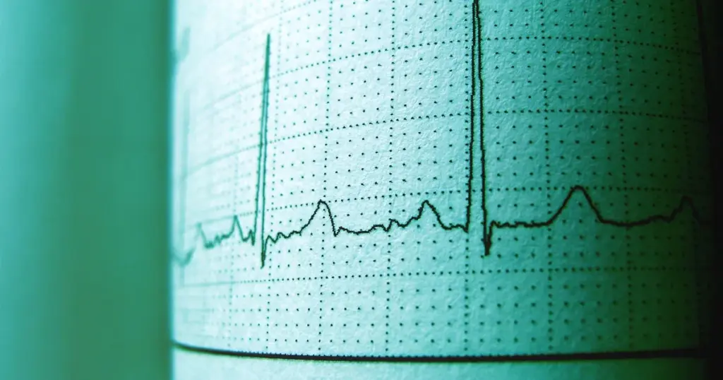 O Que e Monitorizacao Cardiaca Continua